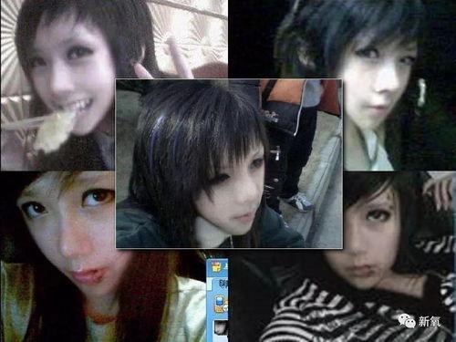 沉珂自残照片,揭开心灵伤痕的勇敢瞬间